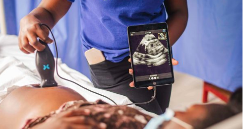 Transforming Maternal and Neonatal Health through Deployment of Portable Ultrasound at Scalebanner image